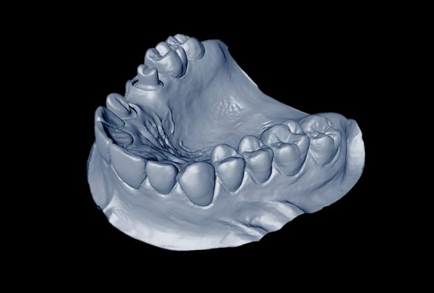 ¿Cómo te pueden ayudar las simulaciones de tratamientos dentales en 3D?